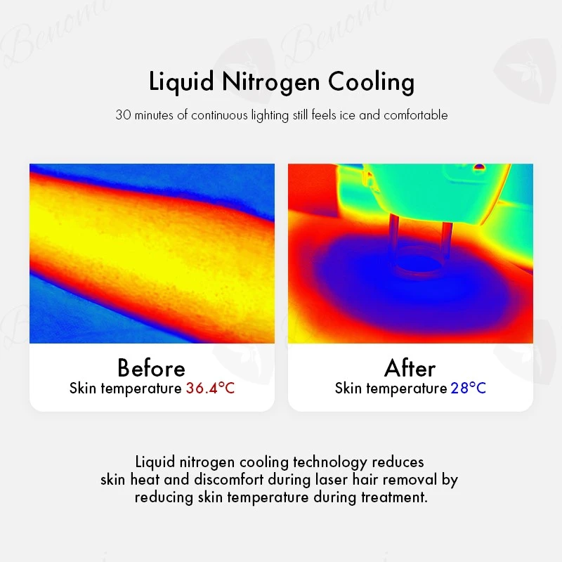 Liquid nitrogen cooling