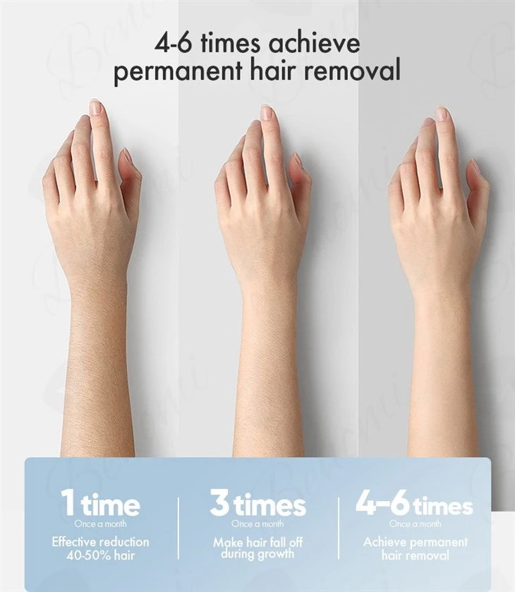 White Diode Laser Hair Removal